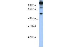 WB Suggested Anti-FEZF1 Antibody Titration:  1 ug/ml  Positive Control:  Hela cell lysate (FEZF1 Antikörper  (C-Term))