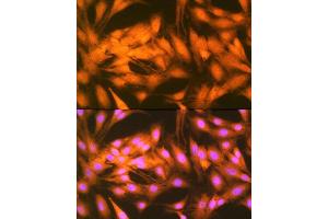 Immunofluorescence analysis of C6 cells using FGF1 Rabbit mAb (ABIN7267182) at dilution of 1:100 (40x lens). (FGF1 Antikörper)
