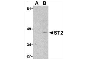 Western blot analysis of ST2 in mouse kidney lysate with this product at 1 μg/ml in the presence (lane A) or absence (lane B) of 1 μg blocking peptide. (IL1RL1 Antikörper  (N-Term))