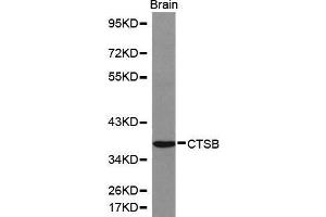 Cathepsin B anticorps  (AA 1-339)
