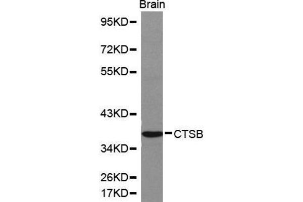 Cathepsin B anticorps  (AA 1-339)