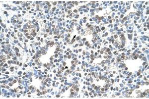 Immunohistochemical staining (Formalin-fixed paraffin-embedded sections) of human lung with MCM3 polyclonal antibody . (MCM3 Antikörper  (AA 726-775))