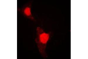 Immunofluorescent analysis of FOXO1 (pS319) staining in HeLa cells. (FOXO1 Antikörper  (pSer319))