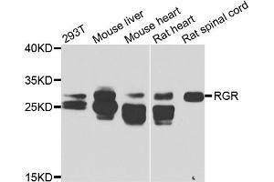 Western blot analysis of extracts of various cell lines, using RGR antibody (ABIN5975227) at 1/1000 dilution. (RGR Antikörper)
