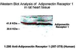Western Blot Analysis of Adiponecitin Receptor 1 in rat heart tissue. (Adiponectin Receptor 1 Antikörper  (AA 357-375))