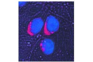 Image no. 3 for anti-Glucose-6-Phosphate Isomerase (GPI) antibody (ABIN347737) (GPI Antikörper)