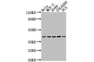 Western Blot Positive WB detected in: Hela whole cell lysate, MCF-7 whole cell lysate, A549 whole cell lysate, COLO205 whole cell lysate, PC-3 whole cell lysate All lanes: LPAR2 antibody at 1:2000 Secondary Goat polyclonal to rabbit IgG at 1/50000 dilution Predicted band size: 40 kDa Observed band size: 40 kDa (EDG4 Antikörper  (AA 8-27))