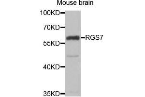 Western blot analysis of extracts of Mouse brain cell line, using RGS7 antibody. (RGS7 Antikörper)