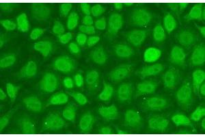 Immunofluorescence analysis of A-549 cells using CXXC1 Polyclonal Antibody (CXXC1 Antikörper)