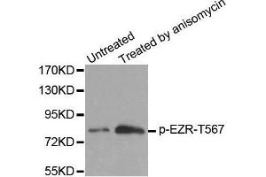 Western blot analysis of extracts from MDA cells, using Phospho-EZR-T567 antibody. (Ezrin Antikörper  (pThr567))