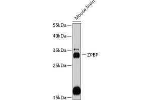 Western blot analysis of extracts of Mouse brain, using ZPBP antibody (ABIN7271569) at 1:1000 dilution. (ZPBP Antikörper  (AA 45-200))