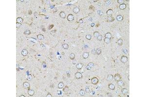 Immunohistochemistry of paraffin-embedded Rat brain using BEST1 Polyclonal Antibody at dilution of 1:100 (40x lens). (Bestrophin 1 Antikörper)