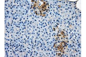 Immunohistochemical staining of paraffin-embedded liver tissue using anti-AKR1A1mouse monoclonal antibody. (AKR1A1 Antikörper)