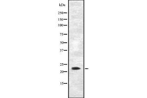 Western blot analysis of AK5 using Jurkat whole cell lysates (Adenylate Kinase 5 Antikörper  (N-Term))
