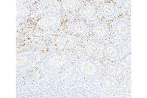 Immunohistochemistry (IHC) image for anti-Interferon alpha/beta Receptor 1 (IFNAR1) (AA 27-436) antibody (ABIN7795662)