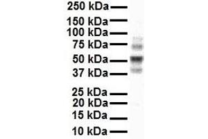 WB Suggested Anti-Ccnd1 antibody Titration: 1 ug/mL Sample Type: Human MCF7 (Cyclin D1 Antikörper  (C-Term))