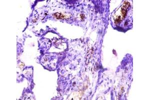 Immunohistochemistry of paraffin-embedded human placenta tissue using ABIN7157091 at dilution of 1:50 (ICA1 Antikörper  (AA 1-268))