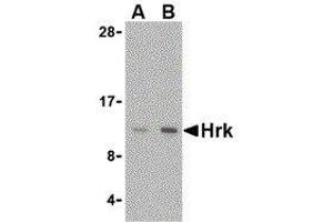 Western Blotting (WB) image for anti-Harakiri, BCL2 Interacting Protein (Contains Only BH3 Domain) (HRK) (Center) antibody (ABIN2474088) (HRK Antikörper  (Center))