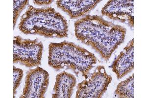 IHC analysis of CUX1 using anti-CUX1 antibody (ABIN7599103). (CUX1 Antikörper  (AA 1-220))