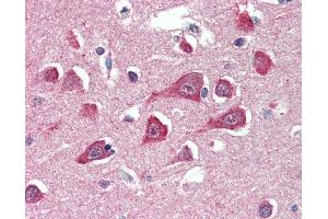 Anti-PLA2G16 antibody IHC of human brain, cortex. (PLA2G16 Antikörper  (AA 2-15))