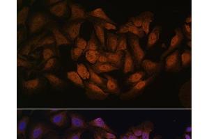 Immunofluorescence analysis of U-2 OS cells using CNBP Polyclonal Antibody at dilution of 1:100. (CNBP Antikörper)
