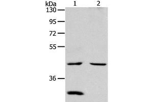 Western Blot analysis of Mouse kidney and heart tissue using NCEH1 Polyclonal Antibody at dilution of 1:1300 (NCEH1 Antikörper)