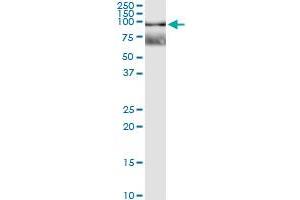 Immunoprecipitation of RNF12 transfected lysate using anti-RNF12 MaxPab rabbit polyclonal antibody and Protein A Magnetic Bead , and immunoblotted with RNF12 purified MaxPab mouse polyclonal antibody (B01P) . (RLIM Antikörper  (AA 1-624))