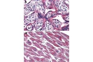Immunohistochemical staining of formalin-fixed, paraffin-embedded human placenta (A) and human heart (B) tissue after heat-induced antigen retrieval. (ADCYAP1R1 Antikörper  (Extracellular Domain))