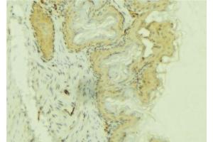 ABIN6274083 at 1/100 staining Mouse colon tissue by IHC-P. (PDLIM1 Antikörper  (Internal Region))
