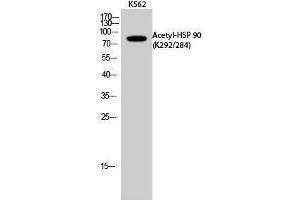 Western Blotting (WB) image for anti-Heat Shock Protein 90 (HSP90) (acLys284), (acLys292) antibody (ABIN3172835) (HSP90 Antikörper  (acLys284, acLys292))