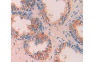 IHC-P analysis of prostate gland tissue, with DAB staining. (CA13 Antikörper  (AA 1-262))