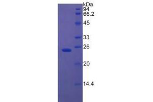 SDS-PAGE analysis of Rat Insulin Like Growth Factor Binding Protein 7 (IGFBP7) Protein. (IGFBP7 Protein)
