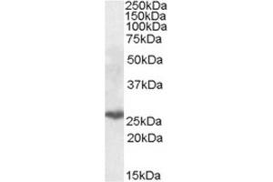 AP23684PU-N PSMB10 Antibody (0. (PSMB10 Antikörper  (Internal Region))