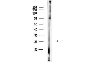 anti-GTP Binding Protein Overexpressed in Skeletal Muscle (GEM) (N-Term) antibody