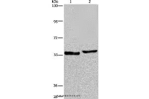 Western blot analysis of Human testis tissue and A375 cell, using SLC1A6 Polyclonal Antibody at dilution of 1:400
