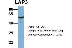 Host: Rabbit  Target Name: LAP3  Sample Tissue: Human Fetal Lung  Antibody Dilution: 1.