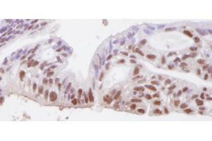 anti-Structural Maintenance of Chromosomes 3 (SMC3) (C-Term) antibody
