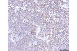 IHC analysis of PLCG 2/PLCG2 using anti-PLCG 2/PLCG2 antibody (ABIN5692854). (Phospholipase C gamma 2 Antikörper  (AA 1201-1258))