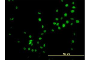 Immunofluorescence (IF) image for anti-NK3 Homeobox 1 (NKX3-1) (AA 100-209) antibody (ABIN518368)