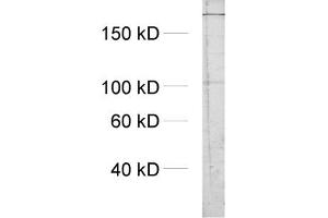 Western Blotting (WB) image for anti-Inositol 1,4,5-Trisphosphate Receptor, Type 1 (ITPR1) (AA 2731-2749) antibody (ABIN1742253)