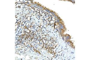 Immunohistochemistry (IHC) image for anti-Tumor Necrosis Factor, alpha-Induced Protein 3 (TNFAIP3) (AA 1-190) antibody (ABIN3022985)