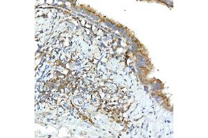 Immunohistochemistry of paraffin-embedded rat lung using TNF Rabbit pAb (ABIN3022984, ABIN3022985, ABIN3022986 and ABIN6219332) at dilution of 1:50 (40x lens). (TNFAIP3 Antikörper  (AA 1-190))