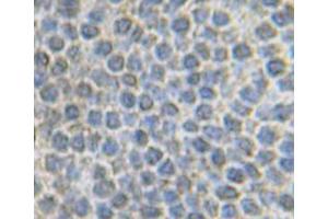 Image no. 3 for anti-Fibroblast Growth Factor 10 (FGF10) antibody (ABIN464943)
