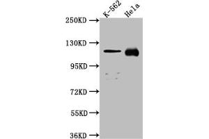 Western Blot Positive WB detected in: K562 whole cell lysate, Hela whole cell lysate All lanes: NUP98 antibody at 1:1000 Secondary Goat polyclonal to rabbit IgG at 1/50000 dilution Predicted band size: 198, 188, 98, 97, 196, 187 kDa Observed band size: 100 kDa (Rekombinanter NUP98 Antikörper)