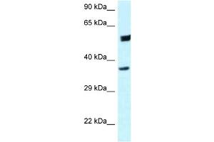 WB Suggested Anti-HOMER3 Antibody Titration: 1. (HOMER3 Antikörper  (C-Term))