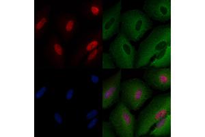 ABIN6259073 and ABIN6273516 staining  cells by IF/ICC.