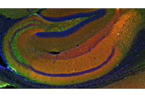 Indirect immunostaining of a PFA fixed mouse hippocampus section with anti-homer 1b/c (dilution 1 : 200; red) and mouse anti-synapsin 1 (cat. (Homer 1b/c (AA 152-354) Antikörper)