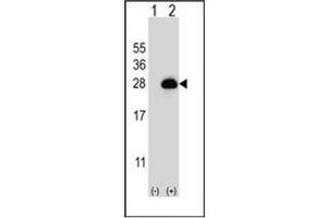 Western blot analysis of RAB3B (arrow) using RAB3B Antibody (C-term) Cat. (RAB3B Antikörper  (C-Term))