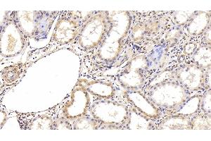 Immunohistochemistry (IHC) image for anti-Hypoxia Inducible Factor 1, alpha Subunit (Basic Helix-Loop-Helix Transcription Factor) (HIF1A) (AA 218-506) antibody (ABIN7426046)