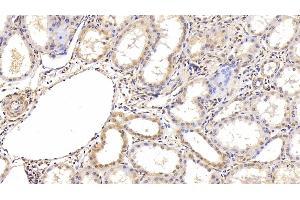 Detection of HIF1a in Human Kidney Tissue using Monoclonal Antibody to Hypoxia Inducible Factor 1 Alpha (HIF1a) (HIF1A Antikörper  (AA 218-506))